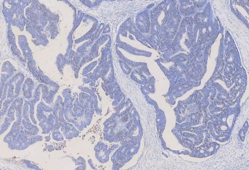 Antigen Retrieval 03